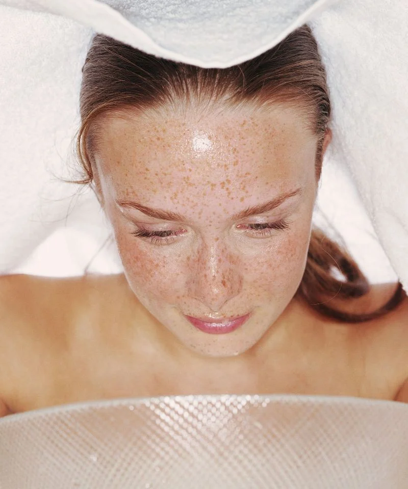 Tips to Get Rid of Acne