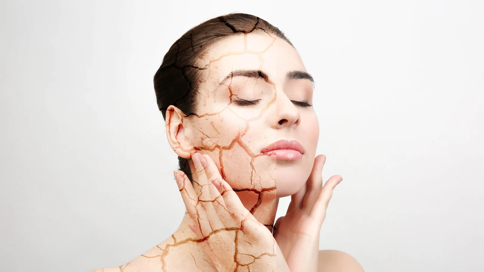Green Tea Treats Dry Skin