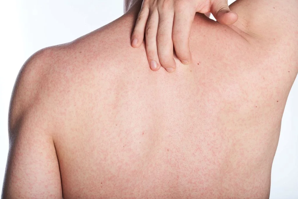 Skin Problems Related to your Work Field