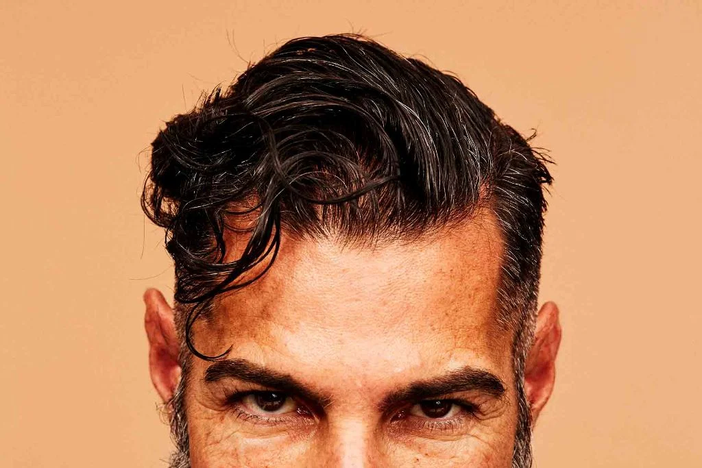 Finasteride