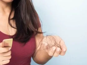 Hair Loss in Women3
