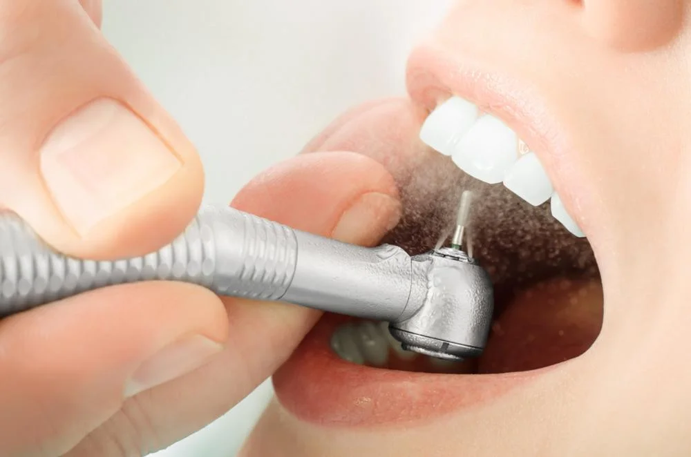 Dental Fillings2
