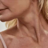 Neck Lift 2